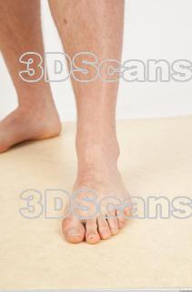 Photo reference of foot 0003